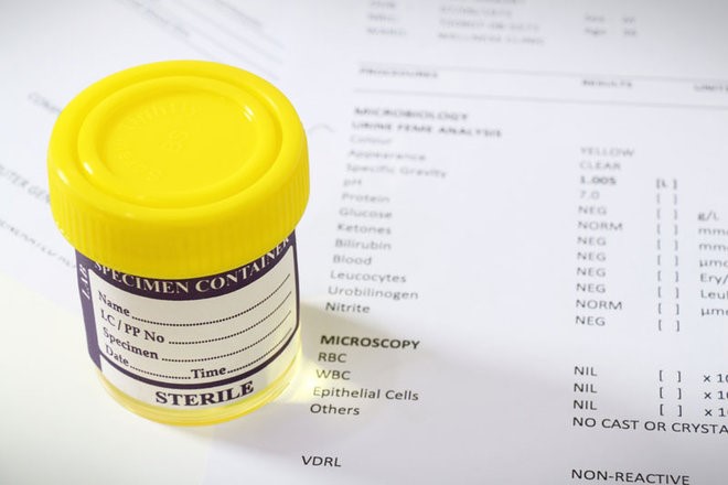 Quick Fix Synthetic Urine Kit Virginia Key Key Biscayne FL